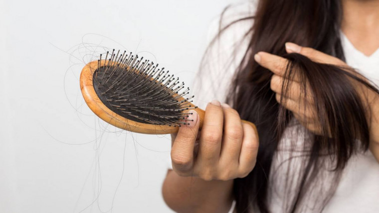 Випадає волосся: які продукти треба їсти, щоб цього уникнути